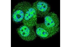 Confocal immunofluorescent analysis of AKT1 Antibody (C-term T450)(Cat#AP50137PU-N) with MCF-7 cell followed by Alexa Fluor 488-conjugated goat anti-rabbit lgG (green). (AKT1 antibody  (C-Term))