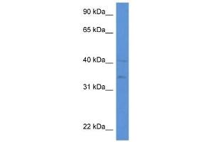 Western Blot showing LIPA antibody used at a concentration of 1 ug/ml against HepG2 Cell Lysate (Lipase A antibody  (N-Term))