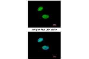 ICC/IF Image Immunofluorescence analysis of paraformaldehyde-fixed HeLa, using ILF1 , antibody at 1:200 dilution. (Forkhead Box K2 antibody  (C-Term))