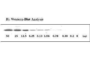 Image no. 3 for Signal Transducer and Activator of Transcription 1, 91kDa (STAT1) ELISA Kit (ABIN625244) (STAT1 ELISA Kit)