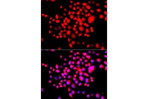 Immunofluorescence analysis of A549 cell using STK19 antibody. (STK19 antibody)