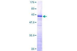 FAM84A Protein (AA 1-292) (GST tag)