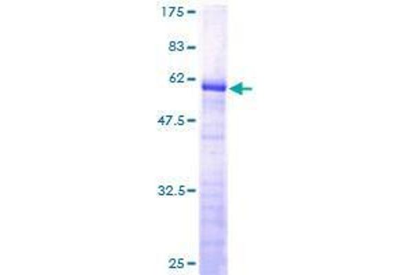 FAM84A Protein (AA 1-292) (GST tag)