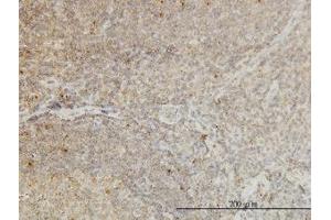 Image no. 1 for anti-Cyclin-Dependent Kinase-Like 4 (CDKL4) (AA 196-295) antibody (ABIN466282) (CDKL4 antibody  (AA 196-295))