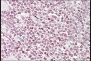 Staining of paraffin embedded Human Tonsil using IKAROS antibody at 1 µg/ml. (IKZF1 antibody  (Internal Region))