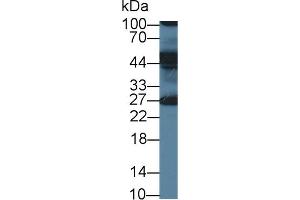 Detection of ERLIN2 in Human Milk using Polyclonal Antibody to Endoplasmic Reticulum Lipid Raft Associated Protein 2 (ERLIN2) (ERLIN2 antibody  (AA 47-339))