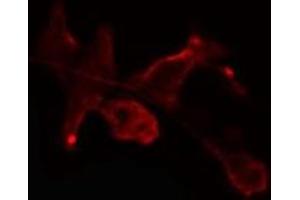 ABIN6275464 staining Hela cells by IF/ICC. (RAB2B antibody  (Internal Region))