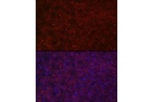 Immunofluorescence analysis of human liver cells using LRG1 Rabbit pAb (ABIN6130528, ABIN6143317, ABIN6143318 and ABIN6223826) at dilution of 1:100 (40x lens). (LRG1 antibody  (AA 36-347))