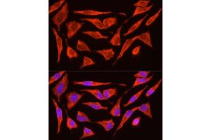 Immunofluorescence analysis of HeLa cells using POMC Rabbit pAb (ABIN3017230, ABIN3017231, ABIN3017232 and ABIN6220004) at dilution of 1:200 (40x lens). (POMC antibody  (AA 1-267))