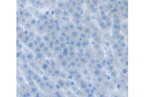 Used in DAB staining on fromalin fixed paraffin- embedded liver tissue (ABCG8 antibody  (AA 1-271))