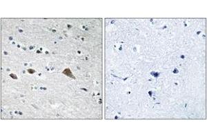 Immunohistochemistry analysis of paraffin-embedded human brain tissue, using BCAR3 Antibody. (BCAR3 antibody  (AA 761-810))