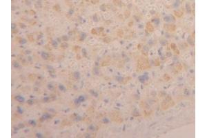Detection of CLCF1 in Human Liver Tissue using Polyclonal Antibody to Cardiotrophin Like Cytokine Factor 1 (CLCF1) (CLCF1 antibody  (AA 88-190))