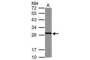 WB Image Sample (50 ug of whole cell lysate) A: mouse brain 12% SDS PAGE antibody diluted at 1:1000 (GSTM5 antibody)