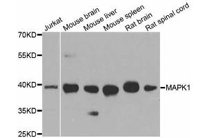 Western blot analysis of extracts of various cell lines, using MAPK1 antibody (ABIN5998180) at 1/1000 dilution. (ERK2 antibody)