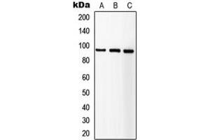 Western blot analysis of IGF1 Receptor expression in HEK293T (A), SP2/0 (B), NIH3T3 (C) whole cell lysates. (IGF1R antibody  (C-Term))