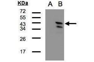 WB Image Western Blot analysis of CAMK1D expression in transfected 293T cell line by CAMK1D polyclonal antibody. (CAMK1D antibody)