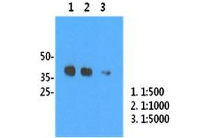 H1N1/HA1 recombinant protein (50ng) were resolved by SDS-PAGE, transferred to PVDF membrane and probed with anti-human H1N1/HA1 antibody (1:500). (Influenza Hemagglutinin HA1 Chain antibody (Influenza A Virus H1N1))