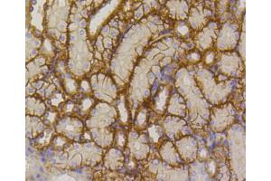 Immunohistochemistry of paraffin-embedded mouse kidney using SLC2A1 antibody (ABIN5997113) at dilution of 1/100 (40x lens).
