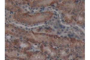 Immunohistochemistry (IHC) image for anti-Neutrophil Cytosolic Factor 4, 40kDa (NCF4) (AA 111-339) antibody (ABIN7442450)