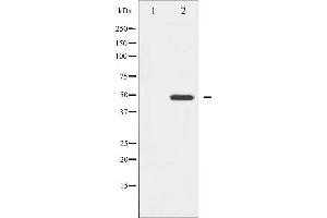 Western blot analysis of GATA4 expression in HeLa whole cell lysates,The lane on the left is treated with the antigen-specific peptide. (GATA4 antibody  (Internal Region))