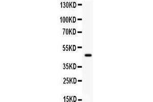 Western Blotting (WB) image for anti-Plasminogen Activator Inhibitor 2 (SERPINB2) (AA 1-180) antibody (ABIN3043329) (SERPINB2 antibody  (AA 1-180))