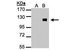 WB Image Western Blot analysis of ZNF281 expression in transfected 293T cell line by ZNF281 polyclonal antibody.