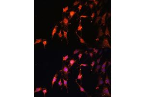 Immunofluorescence analysis of C6 cells using PRR5 antibody (ABIN7269555) at dilution of 1:100. (PRR5 antibody  (AA 109-388))