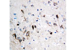 Anti-NMDAR1 antibody, IHC(P) IHC(P): Rat Brain Tissue (GRIN1/NMDAR1 antibody  (N-Term))