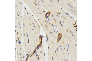 Immunohistochemistry of paraffin-embedded mouse heart using LAMP3 antibody (ABIN5971497) at dilution of 1/200 (40x lens). (LAMP3 antibody)