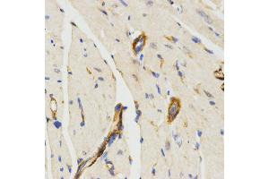Immunohistochemistry of paraffin-embedded mouse heart using LAMP3 antibody (ABIN5971497) at dilution of 1/200 (40x lens).