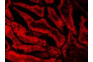 Immunohistochemistry (IHC) image for anti-Glutathione Peroxidase 1 (GPX1) (Internal Region) antibody (ABIN185652)