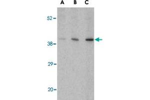 Western blot analysis of C1QTNF5 in Caco-2 cell lysate with C1QTNF5 polyclonal antibody  at (A) 1, (B) 2, and (C) 4 ug/mL . (CTRP5 antibody  (Internal Region))