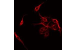 ABIN6275298 staining COLO205 by IF/ICC. (Neurexophilin 4 antibody  (Internal Region))