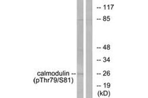 Western blot analysis of extracts from Jurkat cells treated with Insulin 0. (Calmodulin 1 antibody  (pThr79))