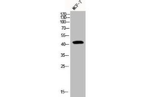 Western Blot analysis of MCF7 cells using Phospho-YAP (S127) Polyclonal Antibody (YAP1 antibody  (pSer127))