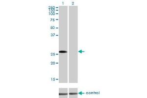 Western blot analysis of CRSP9 over-expressed 293 cell line, cotransfected with CRSP9 Validated Chimera RNAi (Lane 2) or non-transfected control (Lane 1).