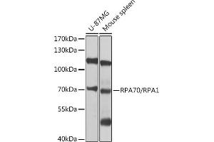 Western blot analysis of extracts of various cell lines, using RP/RP/RP antibody (ABIN3021243, ABIN3021244, ABIN3021245 and ABIN6214082) at 1:1000 dilution. (RPA1 antibody  (AA 367-616))