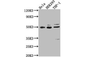 Western Blot Positive WB detected in: Hela whole cell lysate, HEK293 whole cell lysate, THP-1 whole cell lysate All lanes: MAPKAPK2 antibody at 1:1000 Secondary Goat polyclonal to rabbit IgG at 1/50000 dilution Predicted band size: 46, 43 kDa Observed band size: 49 kDa (Recombinant MAPKAP Kinase 2 antibody)