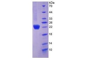 SDS-PAGE analysis of Mouse COL6a1 Protein. (COL6A1 Protein)