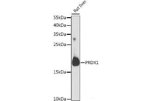 Western blot analysis of extracts of Rat liver using PRDX1 Polyclonal Antibody at dilution of 1:1000. (Peroxiredoxin 1 antibody)