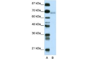 WB Suggested Anti-ZBTB22 Antibody Titration:  0. (ZBTB22 antibody  (C-Term))