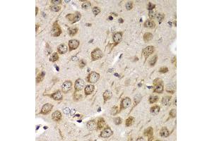 Immunohistochemistry of paraffin-embedded mouse brain using TMED10 Antibody (ABIN5974099) at dilution of 1/100 (40x lens). (TMED10 antibody)