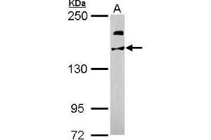 WB Image Sample (50 ug of whole cell lysate) A: Mouse brain 5% SDS PAGE antibody diluted at 1:1000 (USP47 antibody)