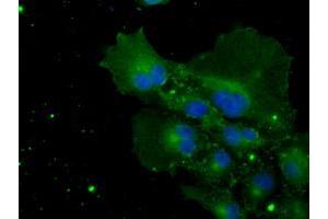Anti-POR mouse monoclonal antibody (ABIN2453490) immunofluorescent staining of COS7 cells transiently transfected by pCMV6-ENTRY POR (RC202172). (POR antibody)
