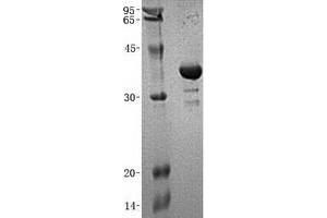 Validation with Western Blot (SGTA Protein (His tag))