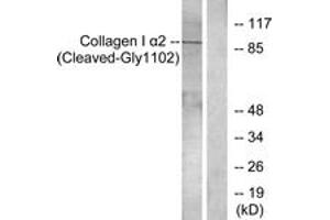 Western blot analysis of extracts from Jurkat cells, treated with etoposide 25uM 24h, using Collagen I alpha2 (Cleaved-Gly1102) Antibody.