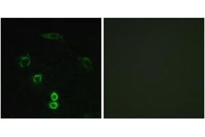 Immunofluorescence analysis of A549 cells, using GLCTK Antibody. (GLYCTK antibody  (AA 101-150))