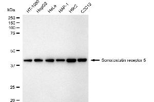 anti-Somatostatin Receptor 5 (SSTR5) antibody