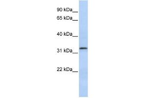 Beta Lactamase 2 antibody used at 1 ug/ml to detect target protein. (LACTB2 antibody  (Middle Region))