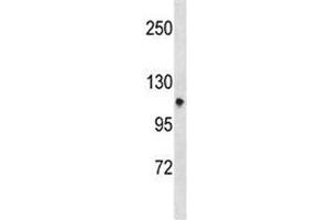 Integrin alpha 7 antibody western blot analysis in CEM lysate. (ITGA7 antibody  (AA 229-257))